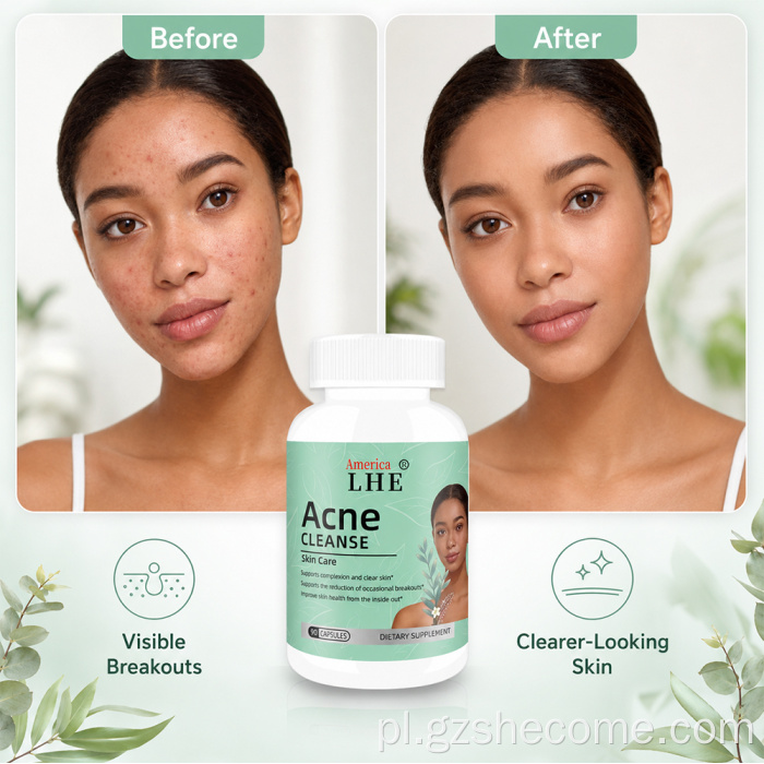 Shecome Acne Capsules Wsparcie zdrowia skóry dla dorosłych